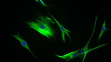 Fluoreszenzmikroskopie zeigt das Zellskelett einer Hautzelle