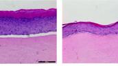 Hautmodelle im Labor vergleichen junge und alte Haut