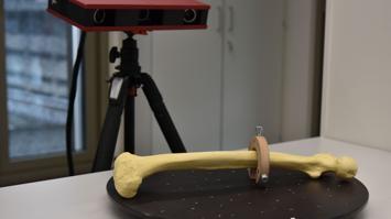 3D-Scanner
