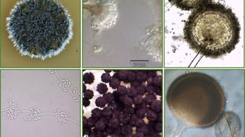 Mikroorganismen im Mikroskop
