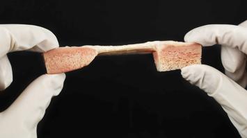 Zwei Hände die ein Patella Ligament halten