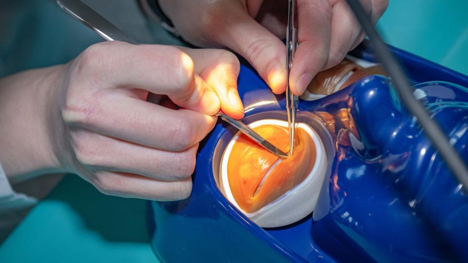 Operation am 3D-gedruckten Auge