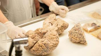 Gehirnforschung - das menschliche Gehirn hautnah