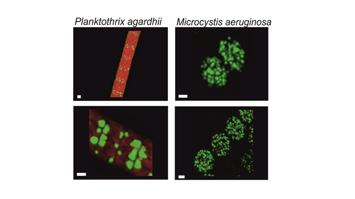 Zwei verschiedene Cyanobakterien mit Markierung von Peptiden in der Zelle bei 1000-facher Vergrößerung im Laser Scanning Mikroskop. Größenbalken = 1 Mikrometer.