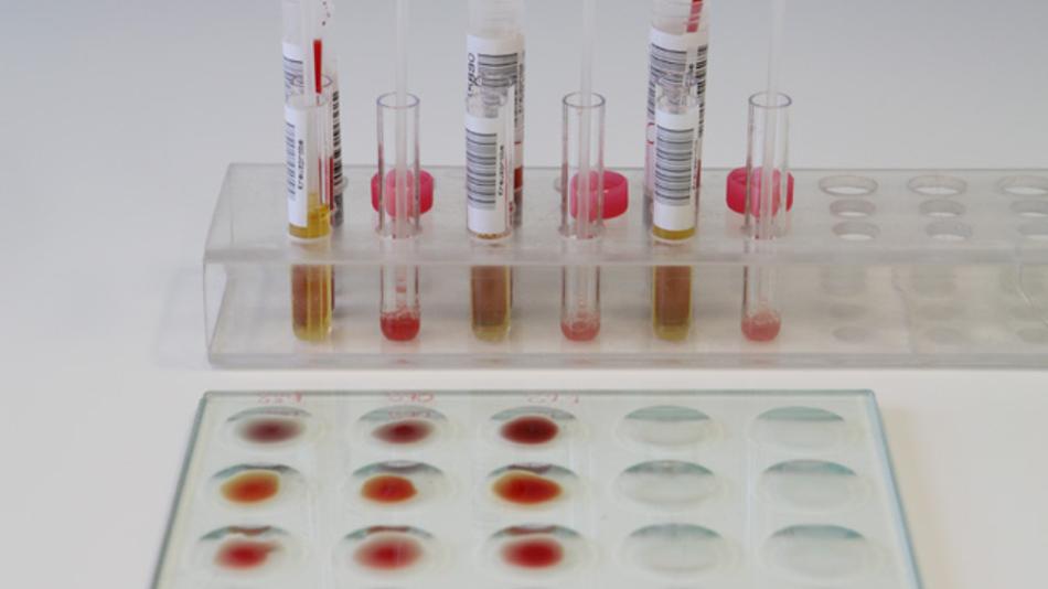 Blutgruppenbestimmung