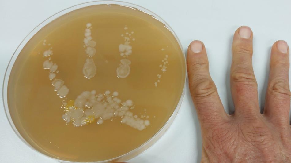 Keime auf den Händen