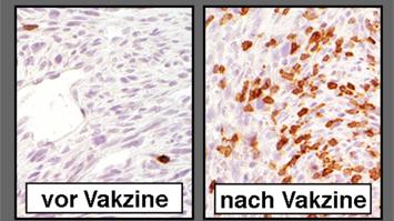 Tumor Vakzine für LNF_Vortrag-Wollmann_resized.jpg