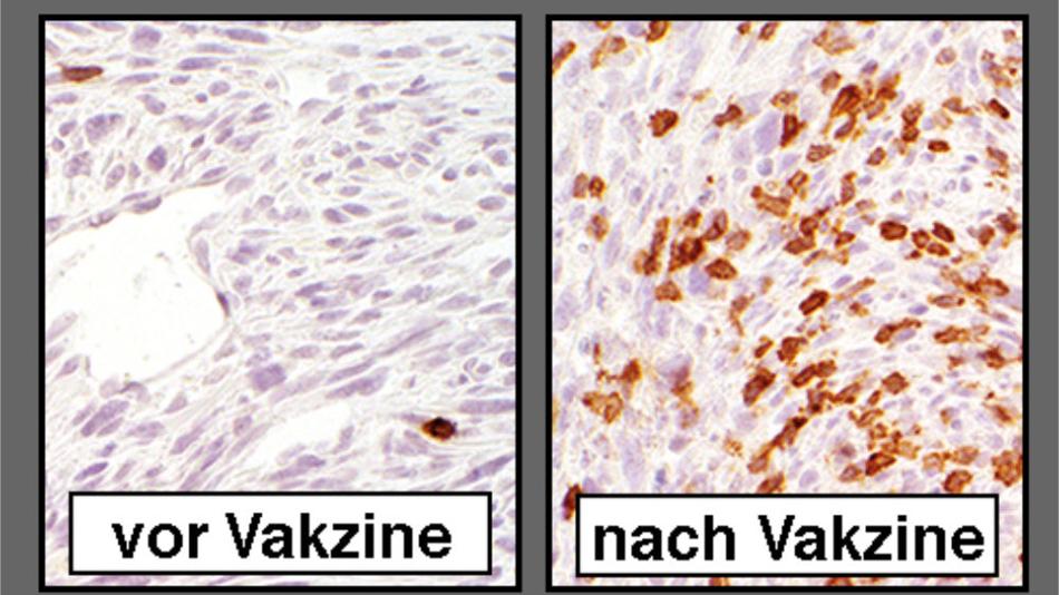 Tumor Vakzine für LNF_Vortrag-Wollmann_resized.jpg