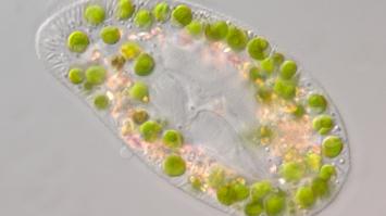 Wimpertierchen, mit eingelagerten Algenzellen in Symbiose, unter dem Mikroskop