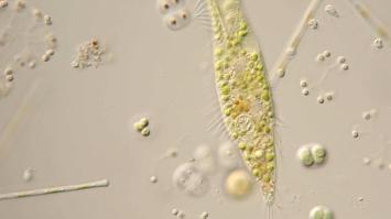 Wimpertierchen unter dem Mikroskop