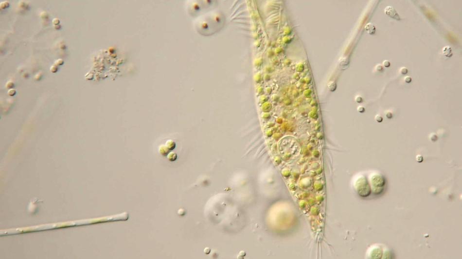 Wimpertierchen unter dem Mikroskop