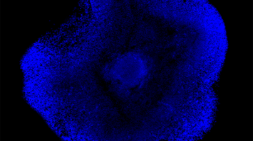 Gehirn-Organoide aus Stammzellen – eine neue Möglichkeit für patientennahe Wissenschaft