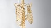 Trichterbrustdeformität Skelett