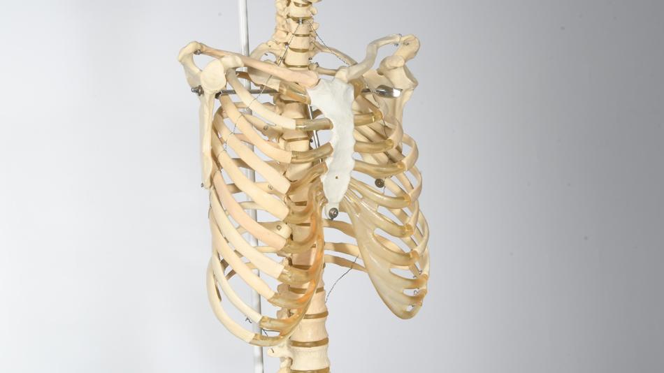 Trichterbrustdeformität Skelett