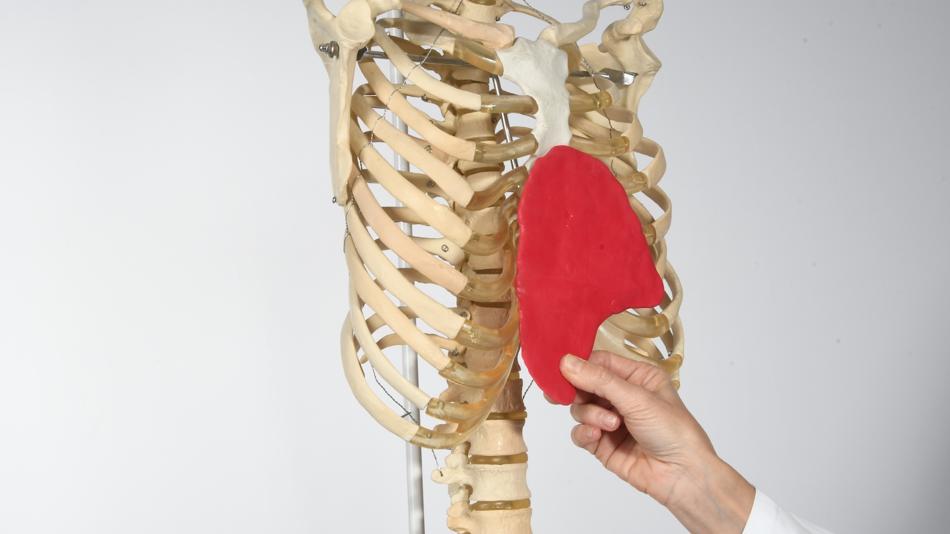 Trichterbrustdeformität S