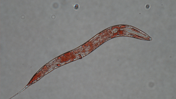 Mikroskopaufnahme Fadenwurm