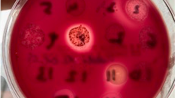 Mikrobiologie an der Universitätszahnklinik