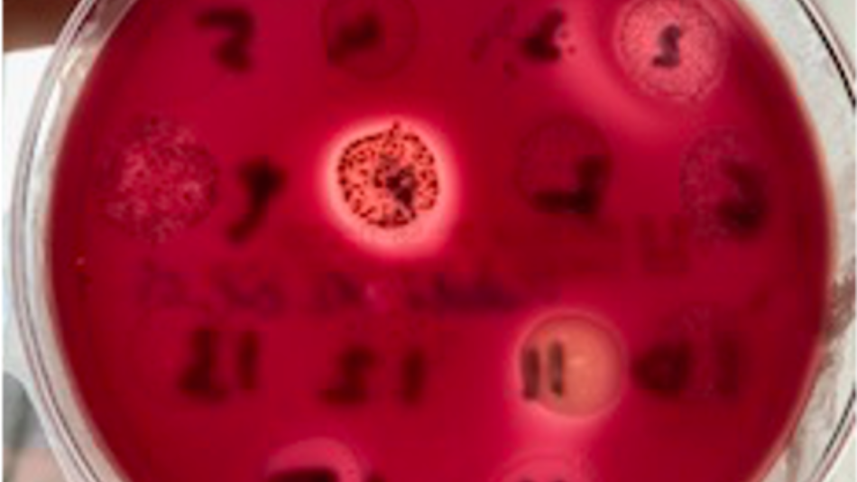 Mikrobiologie an der Universitätszahnklinik