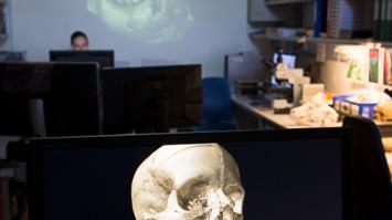 Zähne als Spiegel der Vergangenheit