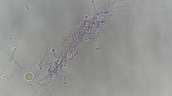 Mikroskopische Aufnahme Pilz