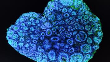 Gehirn-Organoid aus menschlichen Stammzellen