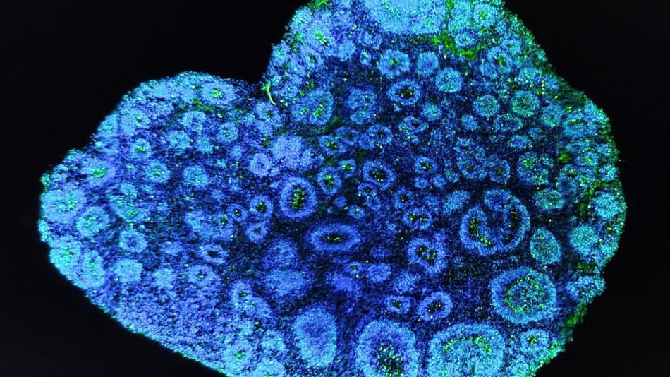 Gehirn-Organoid aus menschlichen Stammzellen