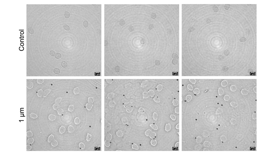 Interaktion von Nano- und Mikroplastikpartiklen mit roten Blutkörperchen