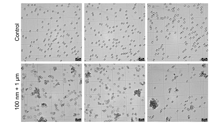 Interaktion von Nano- und Mikroplastikpartiklen mit roten Blutkörperchen