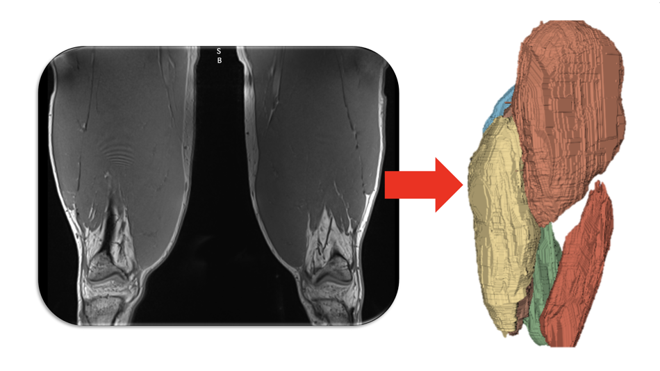 Muskel-Segementation von Magnetresonanzbildern