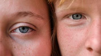 Zwei Gesichtshälfte von Kindern mit Fokus auf Augen.