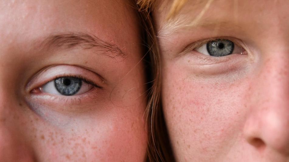 Zwei Gesichtshälfte von Kindern mit Fokus auf Augen.
