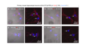 Visualisierung von Peptid-Fluorophoren in Nervenzellen von Mäusen