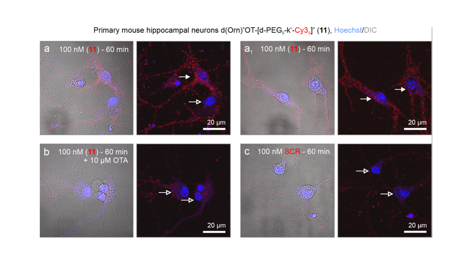 Visualisierung von Peptid-Fluorophoren in Nervenzellen von Mäusen