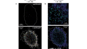 Diffusion von Peptid-Fluorophore gebundenen Oxytocin Rezeptoren