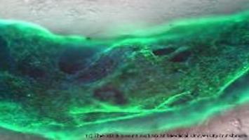 Gedruckter Muskelring im Closeup