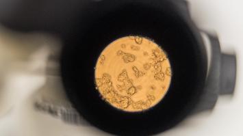 Technologie in der Krebsforschung