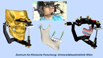 Klinische Forschung für Kiefergelenksdiagnostik