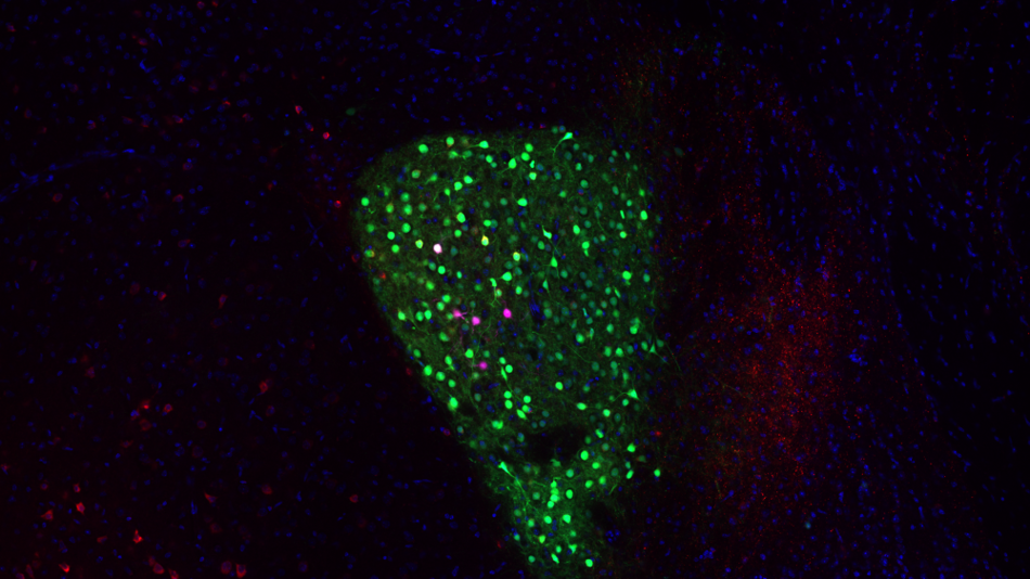 Vom Hirnschnitt zur fluoreszierenden Zelle