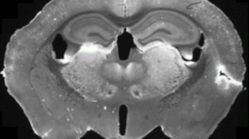 Kartierung der Gehirnzellen