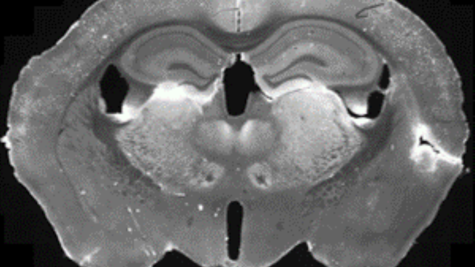 Kartierung der Gehirnzellen