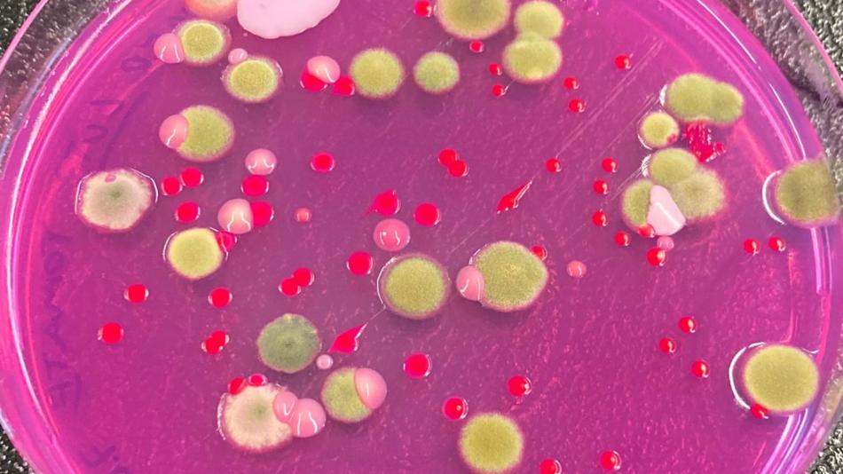 Petrischale mit pinkfarbenem Nährmedium, auf dem verschiedenfarbige Bakterien- und Pilzkolonien wachsen