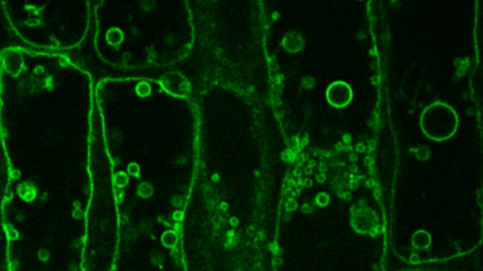 Fluoreszenzmikroskopische Aufnahme von Pflanzenzellen mit grün leuchtenden Zellwänden und kugelförmigen Strukturen im Inneren