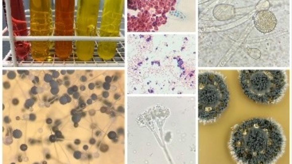 Collage aus Laboraufnahmen mit Reagenzgläsern, mikroskopischen Präparaten und Pilzkolonien in unterschiedlichen Vergrößerungen