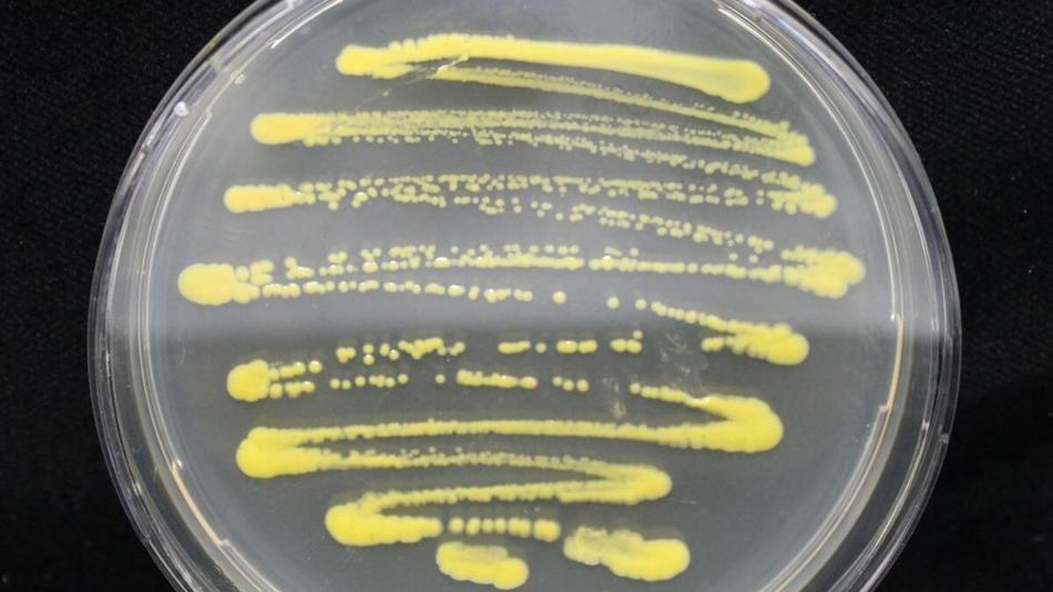 Petrischale mit gelben Bakterien