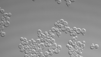 Mikroskopische Aufnahme zahlreicher runder Zellen, die hell vor grauem Hintergrund erscheinen