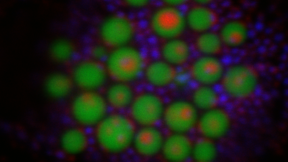 Mikroskopische Aufnahme mit grün und rot fluoreszierenden, kugelförmigen Zellstrukturen vor dunklem Hintergrund