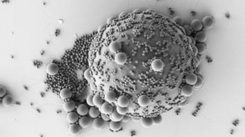 Rasterelektronenmikroskopie (SEM/REM)-Bild von Nanopartikel (MNPs)