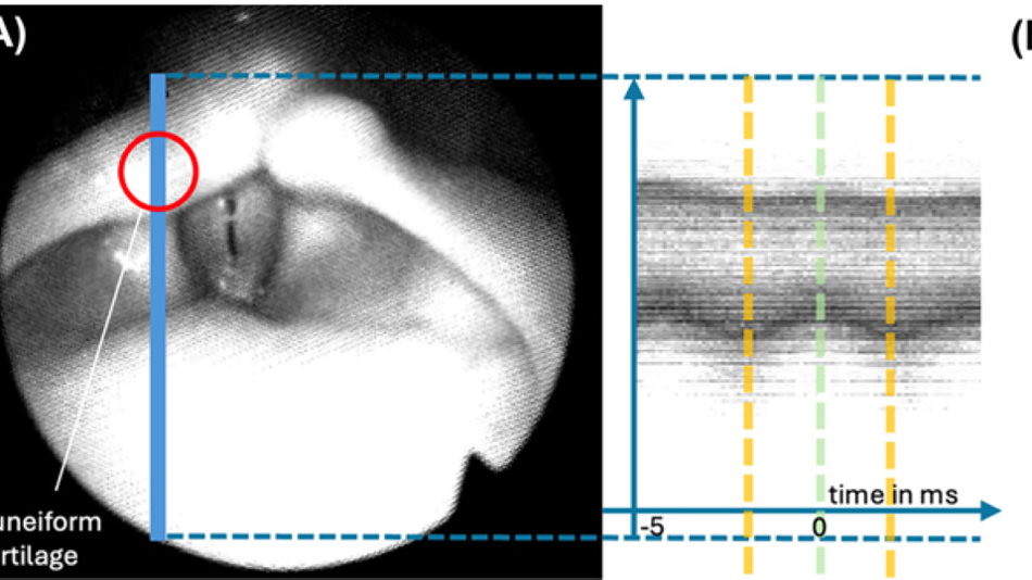 Screenshot Stimmlippen