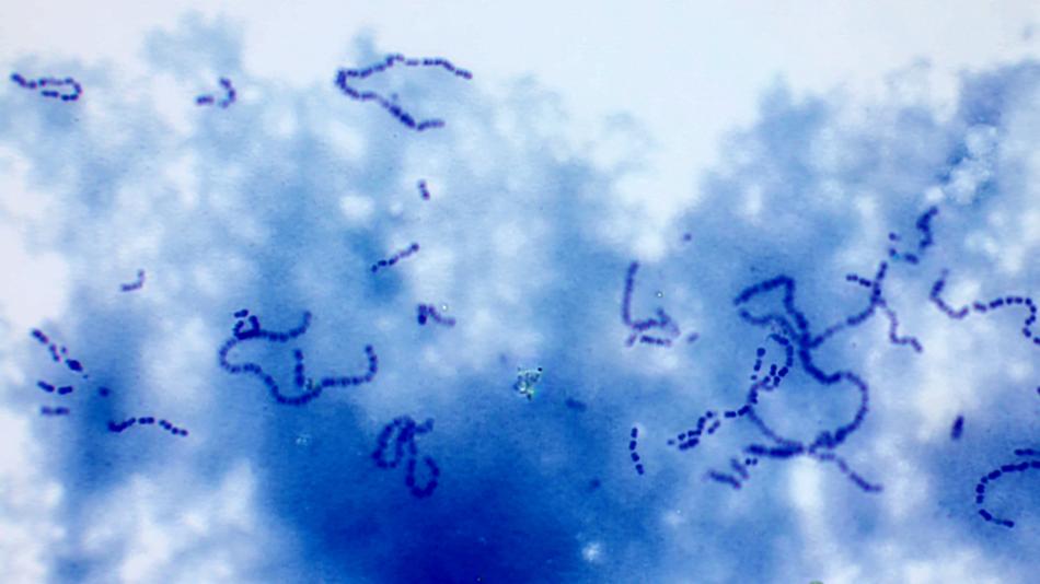 mikroskopisches Bild von Mikroorganismen