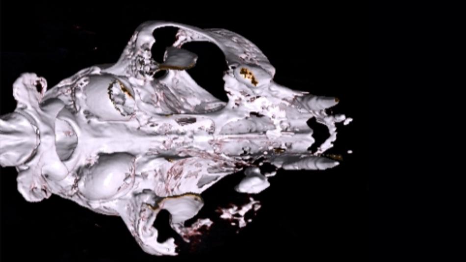 Transversales CT Bild